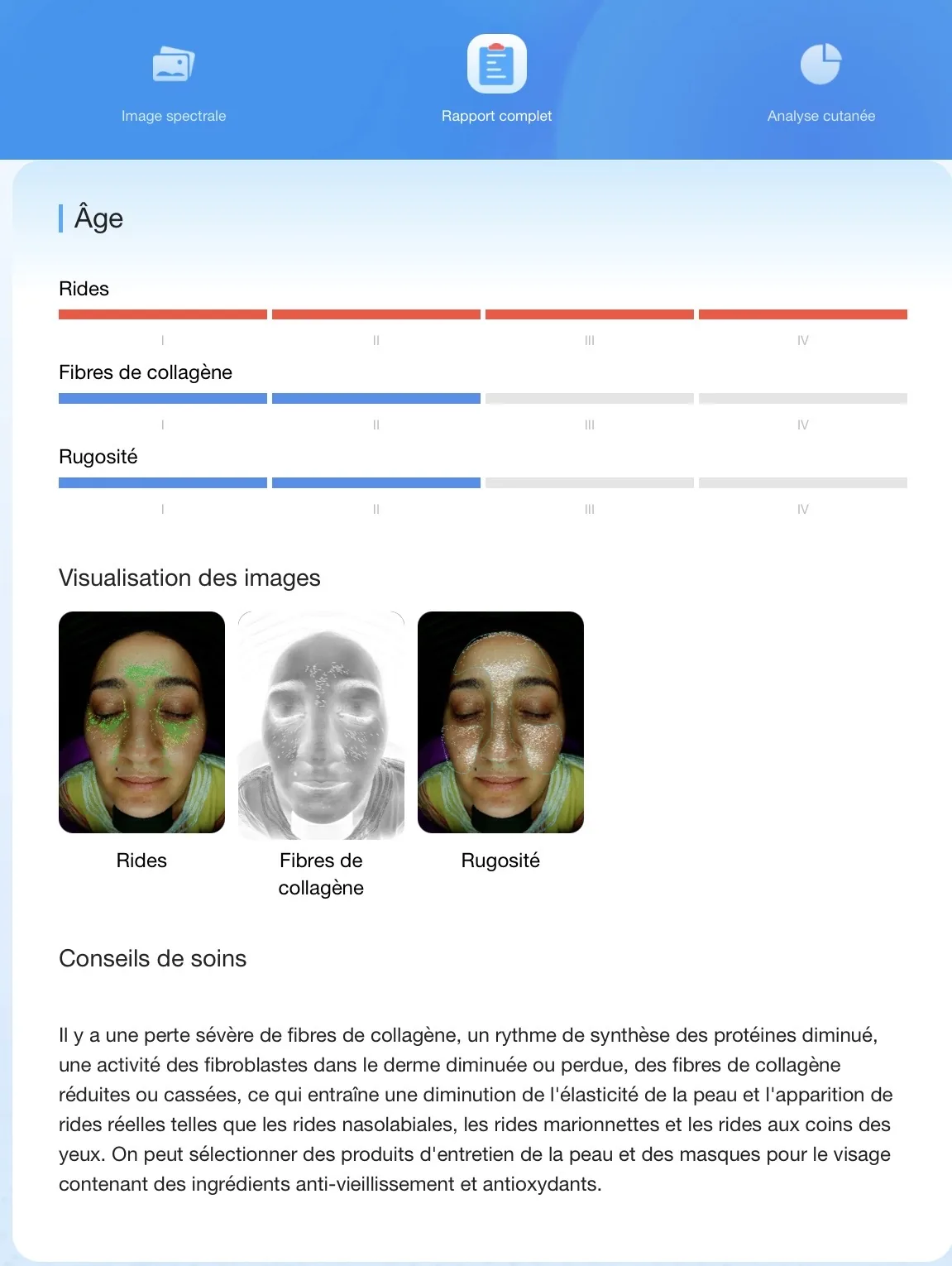Rapport LUNASKIN — Âge